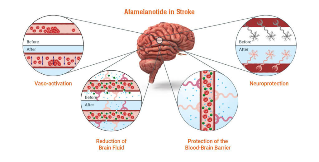 Diagram: Afamelanotide in Stroke